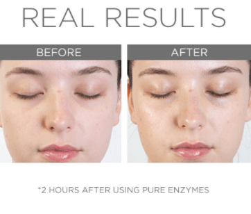 Chemical Exfoliants 101 with Pure Enzymes - Cosmedix