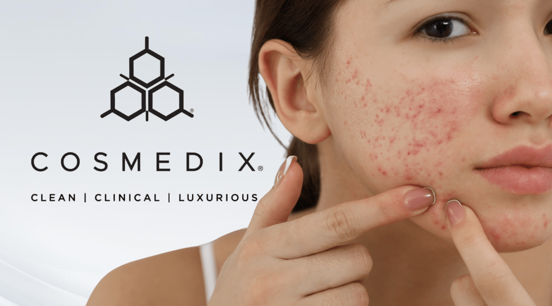 Is an Enzyme Mask Good for Sensitive or Acne‑Prone Skin? Cosmedix’s Guide to Calm, Clear Complexions - Cosmedix