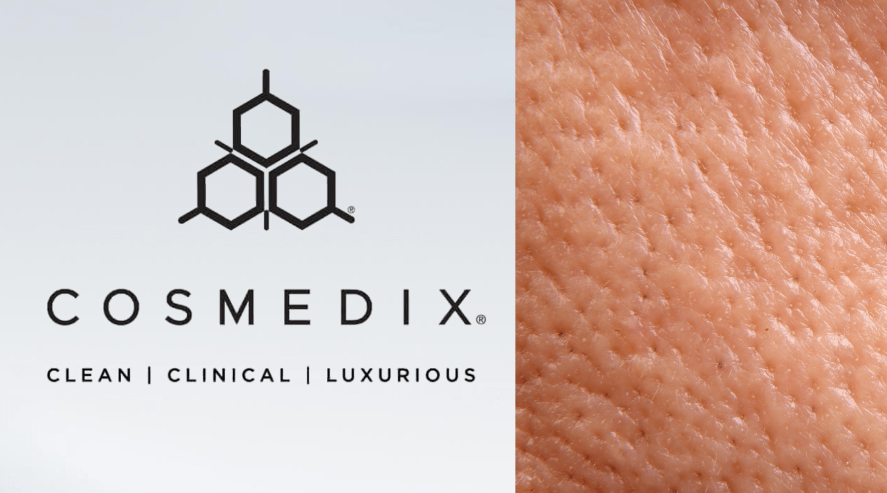 Large Pores and Uneven Texture: A Barrier‑First Approach - Cosmedix