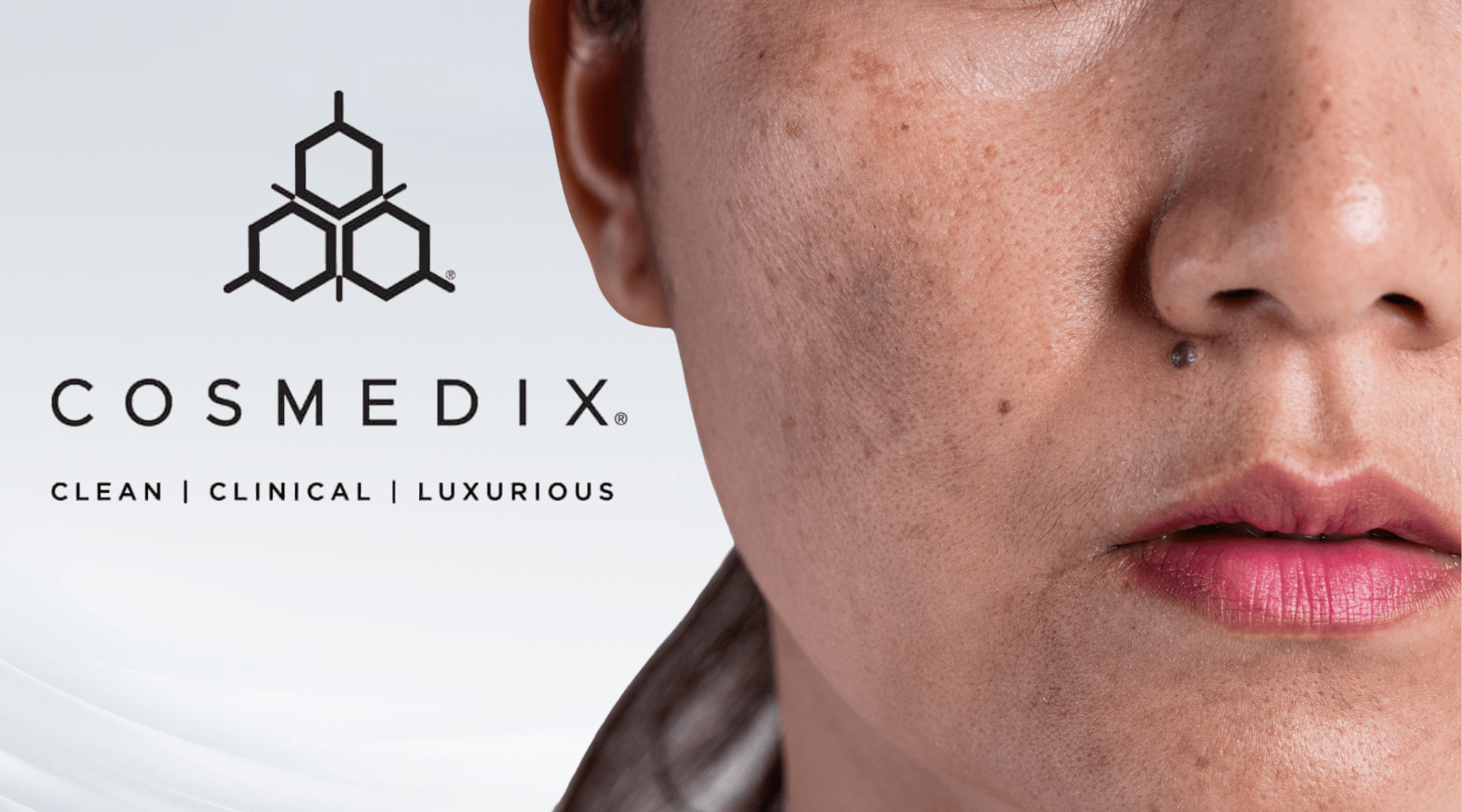 Melasma Isn’t Just Pigment — It’s a Barrier Disorder - Cosmedix