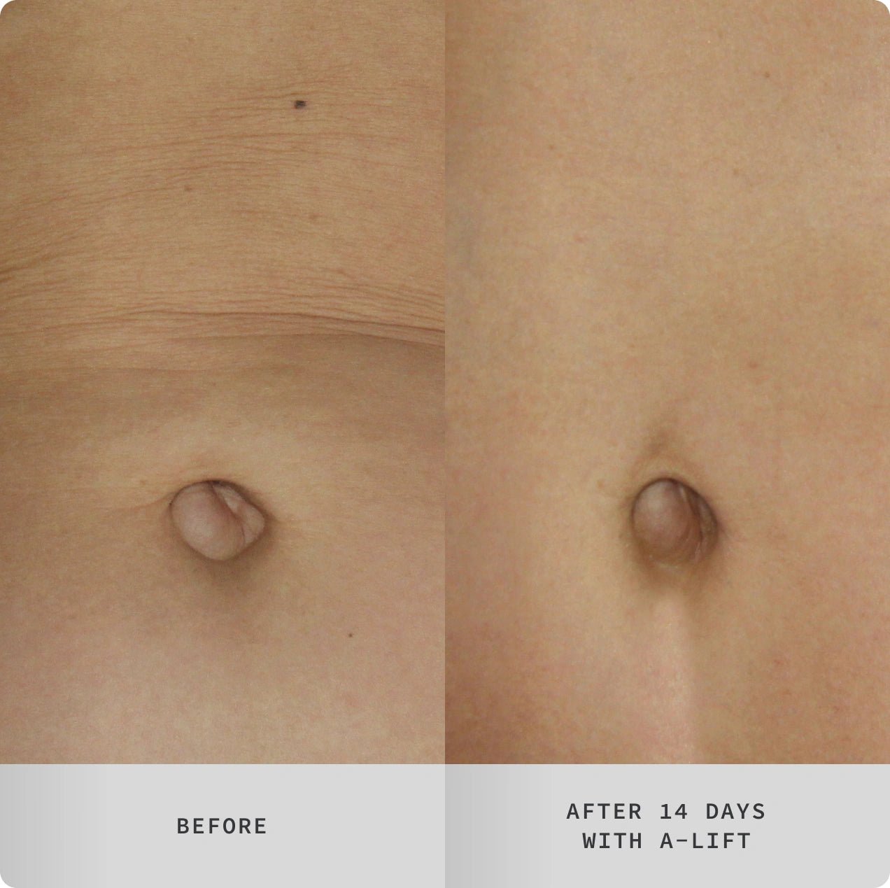 A - Lift Overnight Vitamin A Body Treatment PM - Cosmedix
