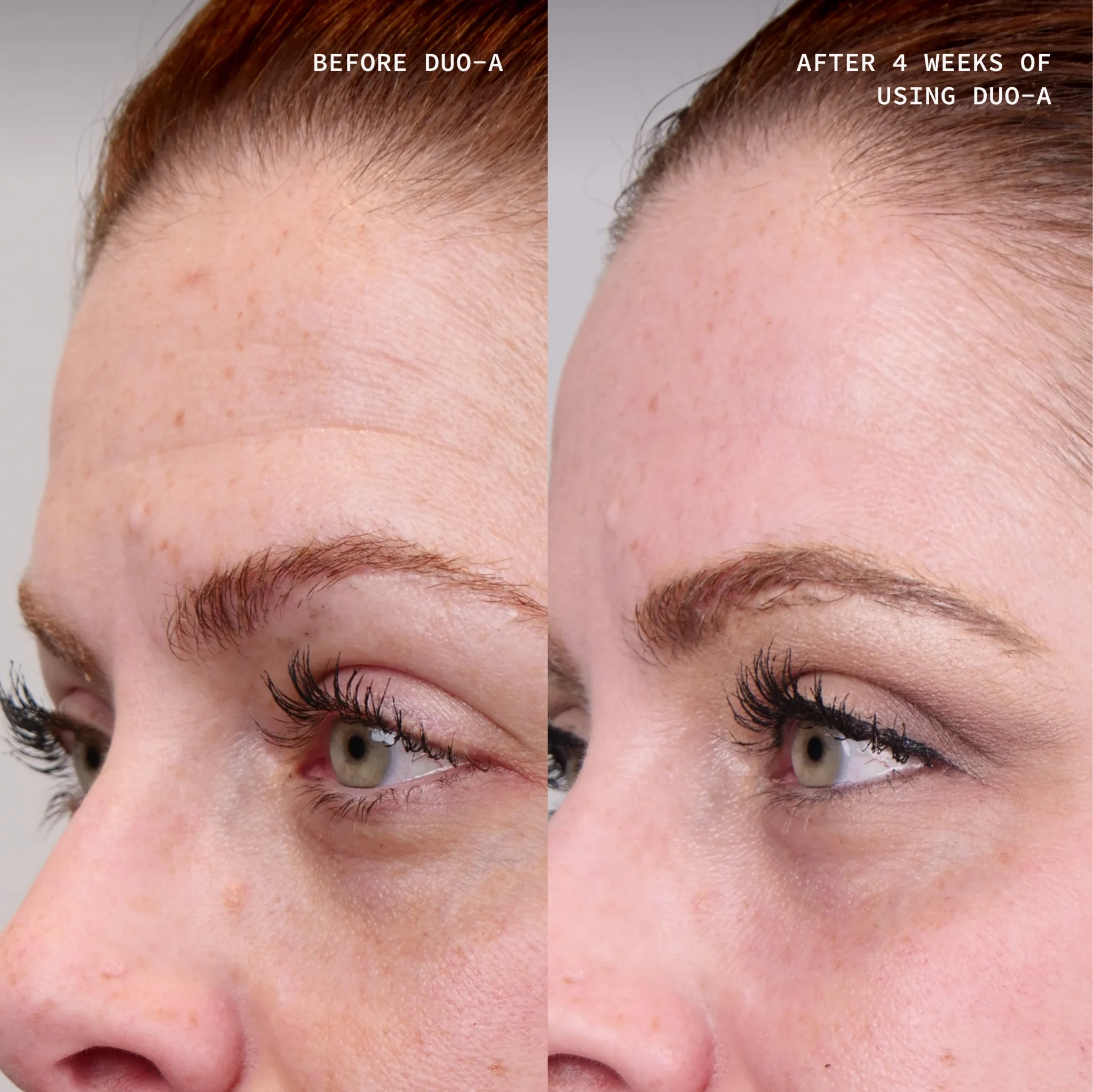 DUO - A 1% Nightly Retinoid Treatment - Cosmedix