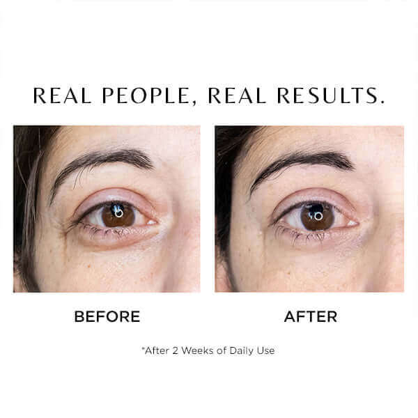 I-Complex - cosmedix-shop