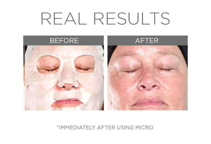 Micro - cosmedix-shop